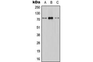 Western blot analysis of CNT1 expression in HEK293T (A), mouse brain (B), H9C2 (C) whole cell lysates. (SLC28A1 anticorps  (Center))