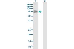 Western Blot analysis of TIGD1 expression in transfected 293T cell line by TIGD1 MaxPab polyclonal antibody. (TIGD1 anticorps  (AA 1-591))