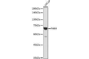 Western blot analysis of extracts of LNCaP cells, using P antibody (ABIN6130472, ABIN6145188, ABIN6145189 and ABIN6215336) at 1:1000 dilution. (PAK4 anticorps  (AA 120-280))