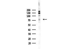 Western blot analysis of lysates from PC12 cells(LPS, 4h treatment), using CROT Antibody at 1/1000 dilution.