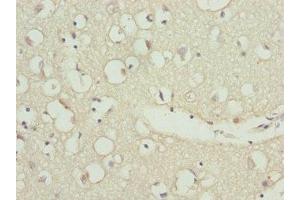 Immunohistochemistry of paraffin-embedded human brain tissue using ABIN7176197 at dilution of 1:100 (ZNF264 anticorps  (AA 1-220))