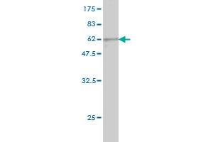 Western Blot detection against Immunogen (57. (PIH1D1 anticorps  (AA 1-290))
