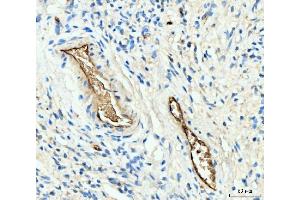 IHC analysis of Hemoglobin/HBA1/HBA2 using anti-Hemoglobin/HBA1/HBA2 antibody (ABIN7602893).