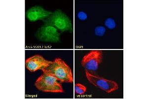 ABIN184965 Immunofluorescence analysis of paraformaldehyde fixed U2OS cells, permeabilized with 0. (TRIM21 anticorps  (C-Term))