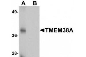 Western blot analysis of TMEM38A in rat skeletal muscle tissue lysate with TMEM38A antibody at 1 μg/mL in (A) the absence and (B) the presence of blocking peptide. (TMEM38A anticorps  (C-Term))