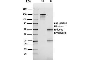 SDS-PAGE Analysis Purified FABP2 Mouse Monoclonal Antibody (CPTC-FABP2-3). (FABP2 anticorps)