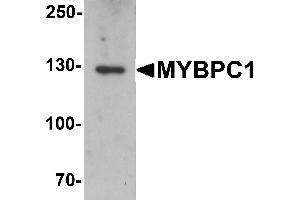 Western blot analysis of MYBPC1 in rat skeletal muscle tissue lysate with MYBPC1 antibody at 1 µg/mL. (MYBPC1 anticorps  (N-Term))