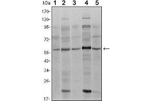 Western blot analysis using SMAD4 mouse mAb against A431 (1), SK-N-SH (2), K562 (3), HepG2 (4) and HUVE12 (5) cell lysate. (SMAD4 anticorps)