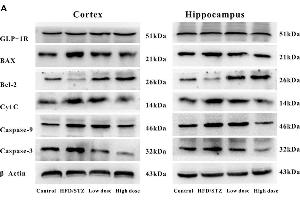 Effects of adapentpronitrile on GLP-1R and mitochondria-dependent apoptosis protein expression induced by HFD/STZ in the rat hippocampus and cortex. (GLP1R anticorps  (AA 101-200))