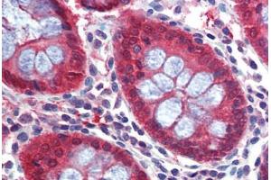 Human Colon: Formalin-Fixed, Paraffin-Embedded (FFPE) (Caspase 7 anticorps  (C-Term))