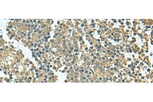 Immunohistochemistry of paraffin-embedded Human tonsil tissue using KRT36 Polyclonal Antibody at dilution of 1:50(x200)