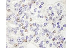 Immunohistochemistry (IHC) image for anti-DEK Oncogene (DEK) (AA 225-275) antibody (ABIN7448525) (DEK anticorps  (AA 225-275))