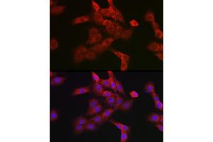 Immunofluorescence analysis of PC-12 cells using Cathepsin B Rabbit pAb (ABIN3021175, ABIN3021176, ABIN3021177 and ABIN6214050) at dilution of 1:100 (40x lens). (Cathepsin B anticorps  (AA 1-339))