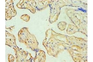Immunohistochemistry of paraffin-embedded human placenta tissue using ABIN7170774 at dilution of 1:100 (SOAT1 anticorps  (AA 1-130))