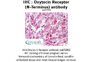 Image no. 1 for anti-Oxytocin Receptor (OXTR) (Extracellular Domain), (N-Term) antibody (ABIN1737740)