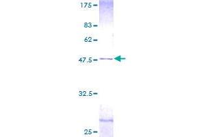 Image no. 1 for Centrin, EF-Hand Protein, 2 (CETN2) (AA 1-172) protein (GST tag) (ABIN1349186)