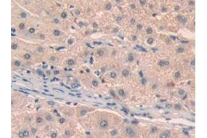 Detection of ATXN10 in Human Liver Tissue using Polyclonal Antibody to Ataxin 10 (ATXN10)