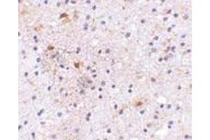 Immunohistochemistry of CAPS1 in human brain with CAPS1 antibody at 5 μg/ml.