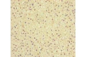 Immunohistochemistry of paraffin-embedded human adrenal gland tissue using ABIN7159655 at dilution of 1:100 (MMACHC anticorps  (AA 63-282))
