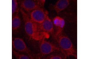 Immunofluorescence staining of methanol-fixed MCF-7 cells using Phospho-KDR-Y1175 antibody (ABIN2988109). (VEGFR2/CD309 anticorps  (pTyr1175))