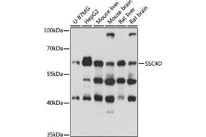 Western blot analysis of extracts of various cell lines, using SSC4D antibody (ABIN7270158) at 1000 dilution.