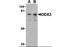 Western Blotting (WB) image for anti-DEAD (Asp-Glu-Ala-Asp) Box Polypeptide 3, X-Linked (DDX3X) (N-Term) antibody (ABIN1031348)