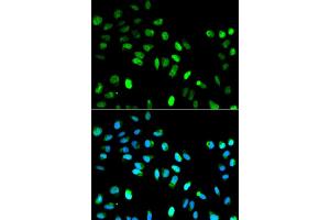 Immunofluorescence analysis of HeLa cell using MAD1L1 antibody. (MAD1L1 anticorps  (AA 360-700))