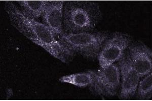 Immunofluorescence staining of HeLa cells (Human cervical epitheloid carcinoma, ATCC CCL-2.