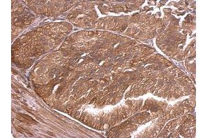 IHC-P Image alpha Adducin antibody detects alpha Adducin protein at membrane and cytosol on mouse prostate by immunohistochemical analysis.