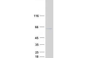 Validation with Western Blot