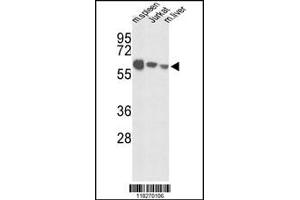 Western blot analysis of IGFALS Antibody in mouse spleen tissue, Jurkat cell line and mouse liver tissue lysates (35ug/lane)