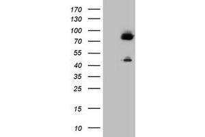 Image no. 1 for anti-Coagulation Factor XIII, A1 Polypeptide (F13A1) antibody (ABIN1498154) (F13A1 anticorps)