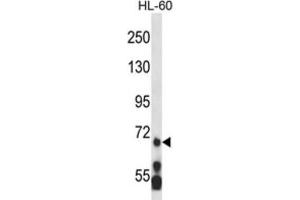 Western Blotting (WB) image for anti-Myeloid/lymphoid Or Mixed-Lineage Leukemia 5 (Trithorax Homolog) (MLL5) antibody (ABIN2995217) (MLL5/KMT2E anticorps)