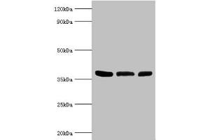 Western blot All lanes: ARG2 antibody at 5 μg/mL Lane 1: Mouse liver tissue Lane 2: 293T whole cell lysate Lane 3: Mouse kidney tissue Secondary Goat polyclonal to rabbit IgG at 1/10000 dilution Predicted band size: 39 kDa Observed band size: 39 kDa