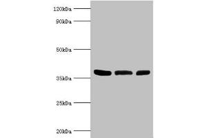 Western blot All lanes: ARG2 antibody at 5 μg/mL Lane 1: Mouse liver tissue Lane 2: 293T whole cell lysate Lane 3: Mouse kidney tissue Secondary Goat polyclonal to rabbit IgG at 1/10000 dilution Predicted band size: 39 kDa Observed band size: 39 kDa (ARG2 anticorps  (AA 1-354))