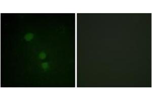 Immunofluorescence analysis of HeLa cells, using Histone H2B (Acetyl-Lys15) Antibody. (Histone H2B anticorps  (acLys15))