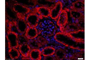 Paraformaldehyde-fixed, paraffin embedded rat kidney, Antigen retrieval by boiling in sodium citrate buffer (pH6) for 15min, Block endogenous peroxidase by 3% hydrogen peroxide for 30 minutes, Blocking buffer (normal goat serum) at 37°C for 20min, Antibody incubation with Rabbit Anti-FZD3/Frizzled 3 Polyclonal Antibody, Unconjugated  at 1:200 overnight at 4°C, followed by the secondary antibody was Goat Anti-Rabbit IgG, Cy3 conjugated-Cy3)used at 1:200 dilution for 40 minutes at 37°C.