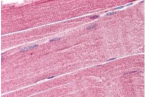 Human Skeletal Muscle (formalin-fixed, paraffin-embedded) stained with TRIM63 antibody ABIN293523 at 1. (TRIM63 anticorps  (AA 2-14))