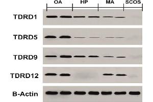 Western blotting test results for protein expression of TDRDs genes in HP, MA, SCOS, and OA samples compared to control group Source: PMID32059713 (TDRD1 anticorps  (AA 837-968))