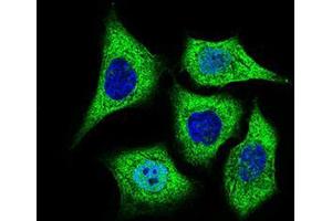 Immunofluorescence analysis of HepG2 cells using ALDH2 mouse mAb (green).