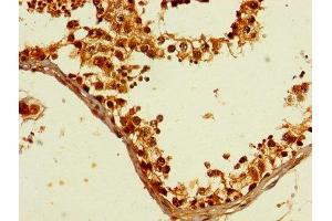 anti-General Transcription Factor IIB (GTF2B) (AA 1-316) antibody