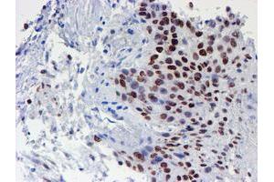 Image no. 8 for anti-WW Domain Containing Transcription Regulator 1 (WWTR1) antibody (ABIN1501763) (WWTR1 anticorps)