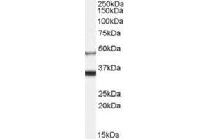 AP31067PU-N HCRTR1 antibody staining of Human Brain lysate at 0. (HCRTR1 anticorps  (Internal Region))