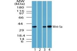 Image no. 1 for anti-Wingless-Type MMTV Integration Site Family, Member 5A (WNT5A) (AA 190-230) antibody (ABIN207746)
