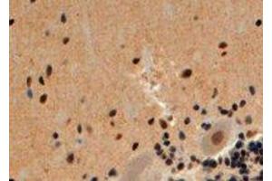 Immunohistochemistry (IHC) image for anti-S-Antigen, Retina and Pineal Gland (Arrestin) (SAG) (Internal Region) antibody (ABIN2465438)
