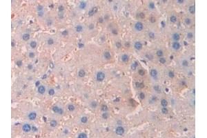 Detection of CA7 in Mouse Liver Tissue using Polyclonal Antibody to Carbonic Anhydrase VII (CA7)