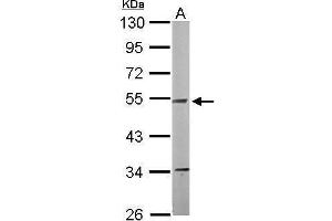 WB Image Sample (50 ug of whole cell lysate) A: Mouse brain 10% SDS PAGE antibody diluted at 1:1000