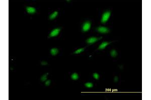 Immunofluorescence of purified MaxPab antibody to NFAM1 on HeLa cell.
