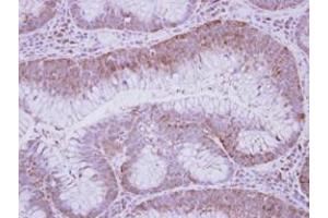 Image no. 1 for anti-Glucose-Fructose Oxidoreductase Domain Containing 2 (GFOD2) (AA 198-385) antibody (ABIN1498450) (GFOD2 anticorps  (AA 198-385))