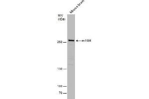 WB Image mTOR antibody detects mTOR protein by western blot analysis.